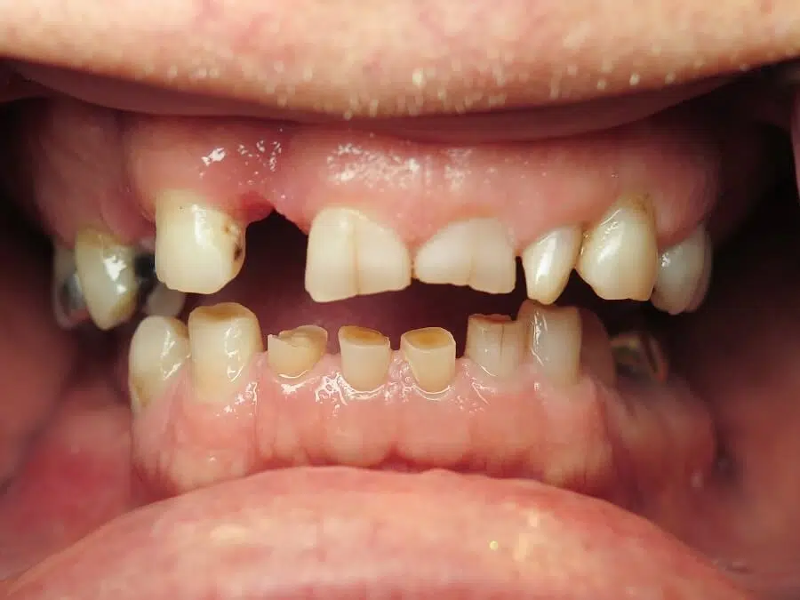 Before image